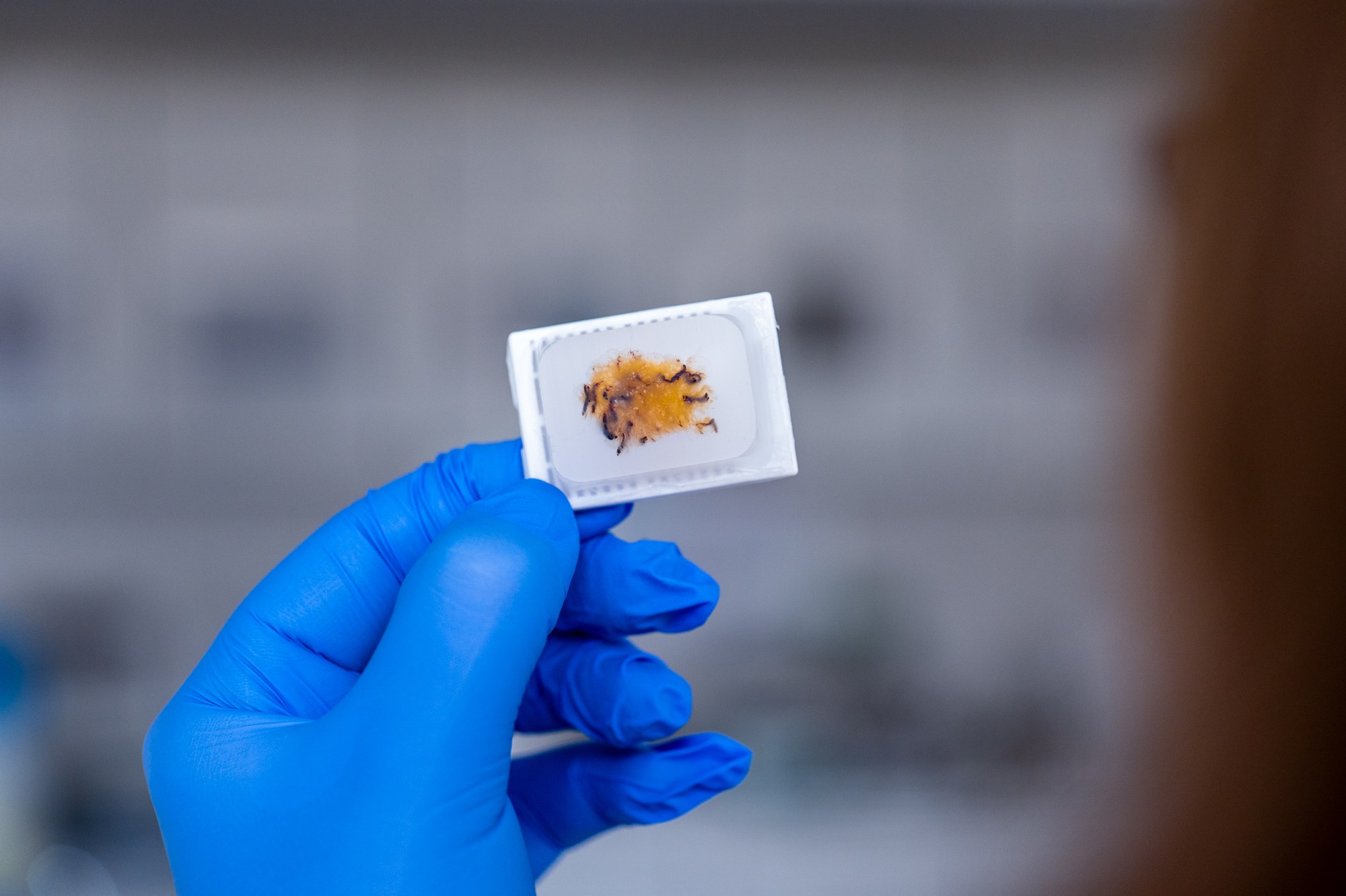 Czech biobank network received funding for development and modernisation